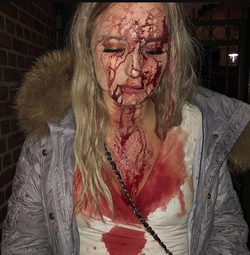 The photo of Sophie Johansson taken moments after being violently assaulted.
