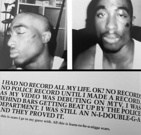 Photos of 2Pac after being brutalized by the Oakland Police Department