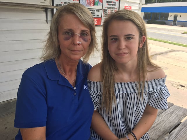Photo of the victims, Jeanette Norris and her 15-year-old daughter Makiddian Norris after the assault