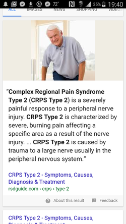 Further explaining of Type Two CRPS