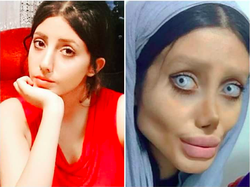 Sahar Tabar pictured before and after her surgeries