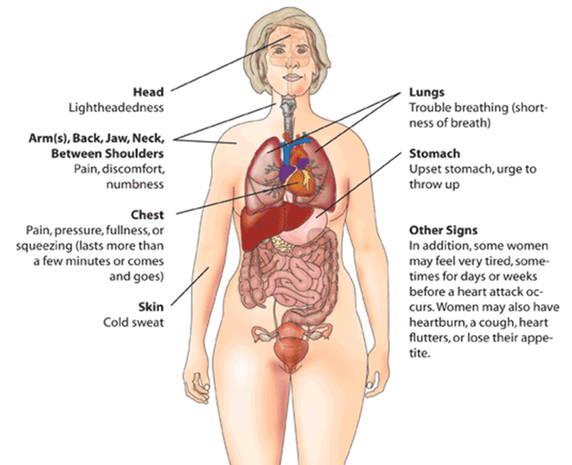 Range of myocardial infarction symptoms in women