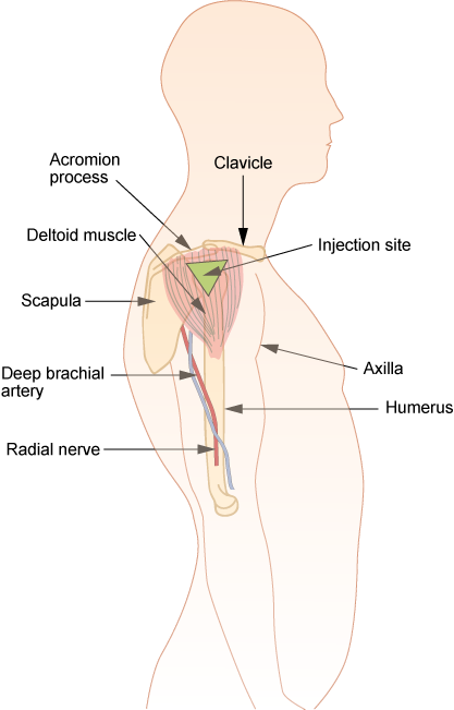 Diagram showing the  deltoid site for intramuscular injection