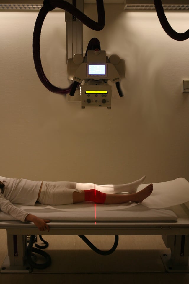 Radiography used to identify possible bone fractures after a knee injury.