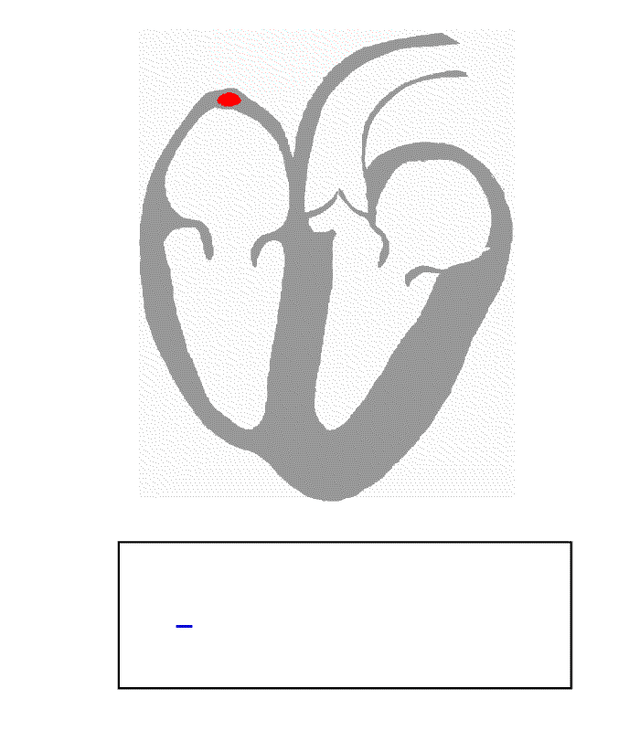 Transmission of a cardiac action potential through the conduction system of the normal human heart