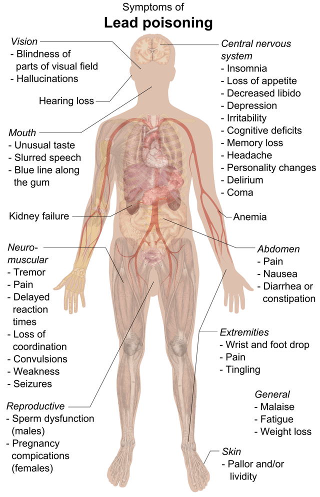 Symptoms of lead poisoning