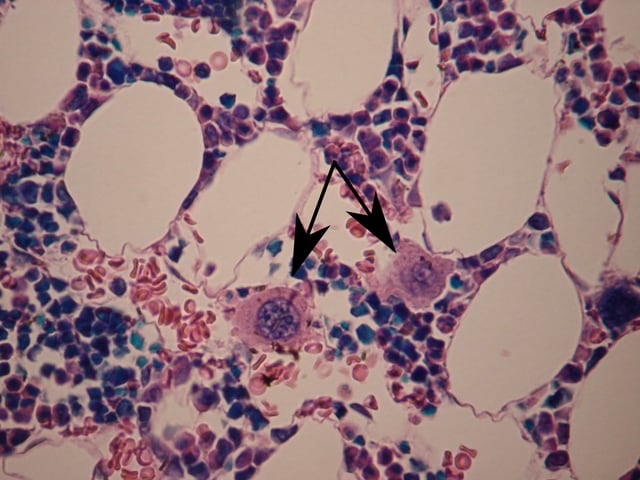 Megakaryocytes (arrows)