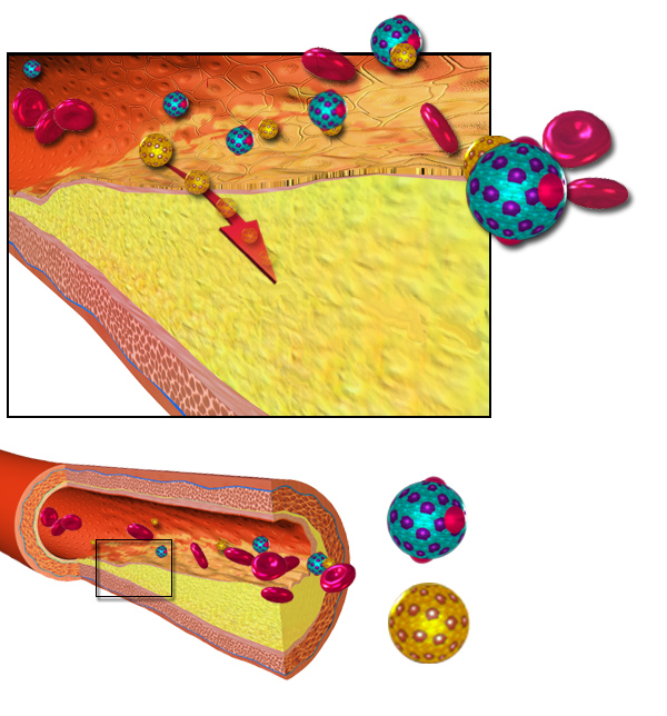 Atherosclerosis and lipoproteins