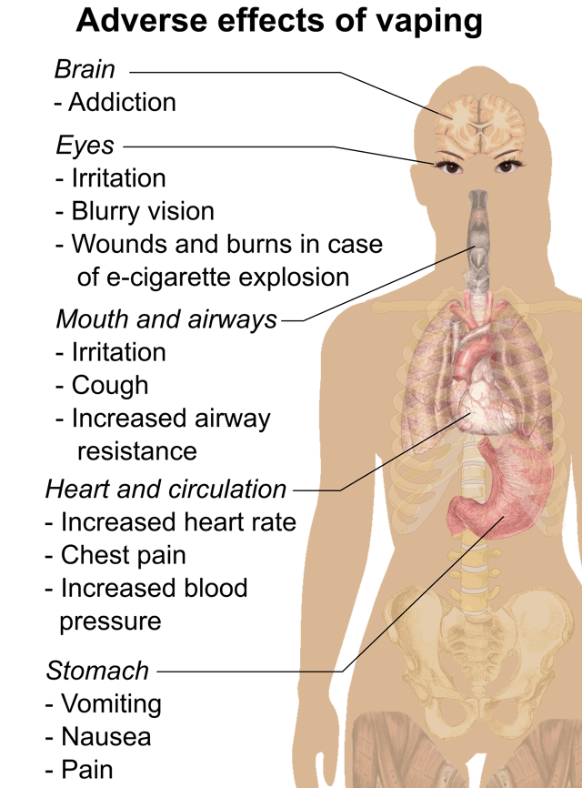 Possible adverse effects of vaping.