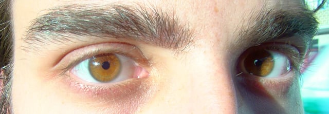 Amber eyes in sunlight – displaying an orange color rather than brown