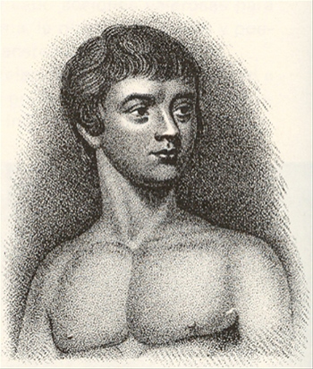 Portrait of Victor of Aveyron, a feral child caught in 1798 who displayed possible symptoms of autism