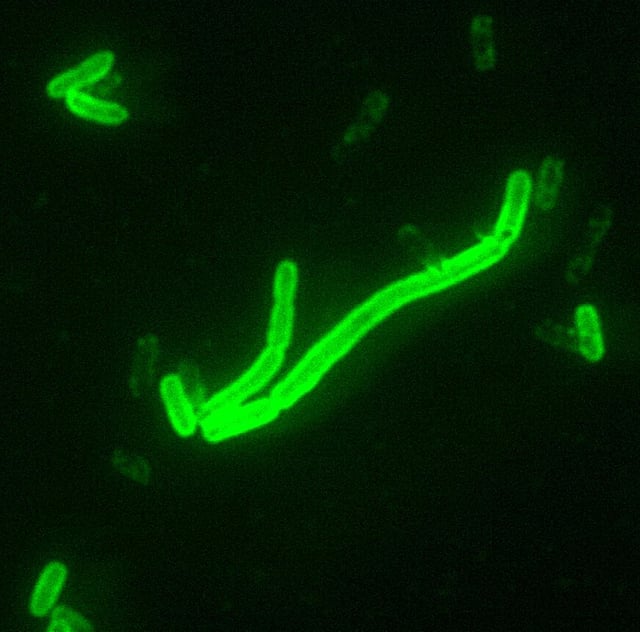 Yersinia pestis (200x magnification), the bacterium which causes bubonic plague