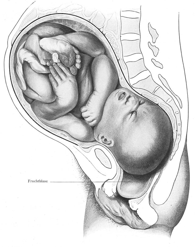 Engagement of the fetal head