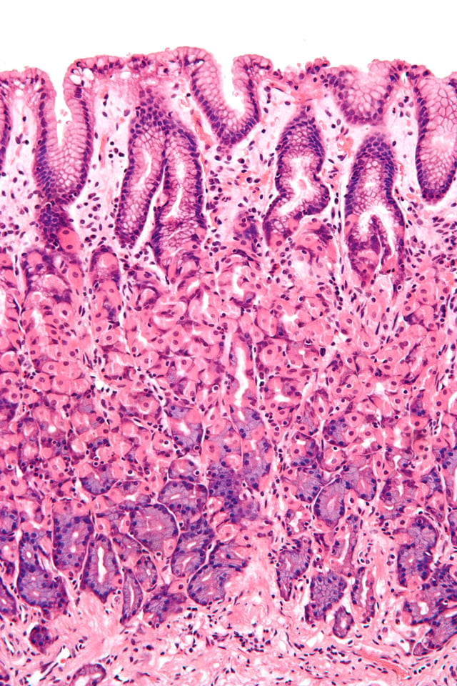 Micrograph showing a cross section of the human stomach wall in the body portion of the stomach. H&E stain.