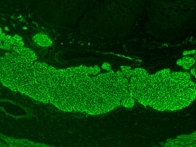 Immunofluorescence staining pattern of endomysial antibodies on a monkey oesophagus tissue sample.