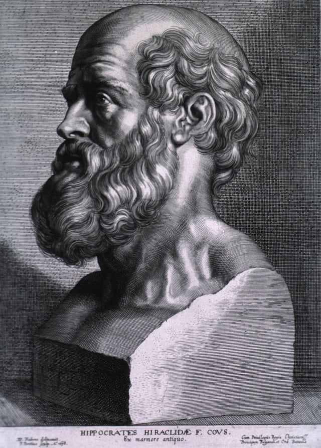 Hippocrates, 17th century engraving by Peter Paul Rubens of an antique bust