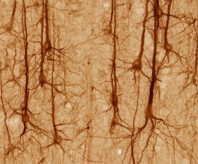 SMI32-stained pyramidal neurons in cerebral cortex