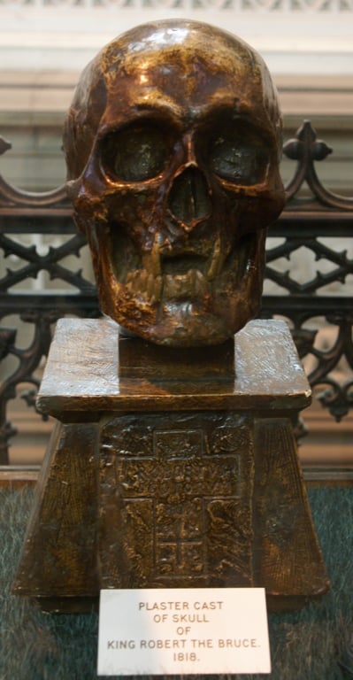Plaster cast of Robert I's skull by William Scoular