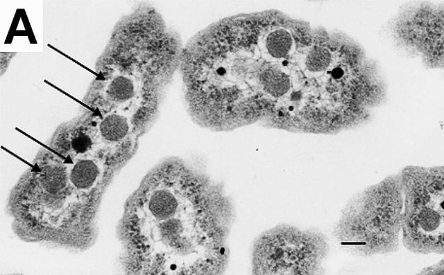An electron micrograph of Halothiobacillus neapolitanus