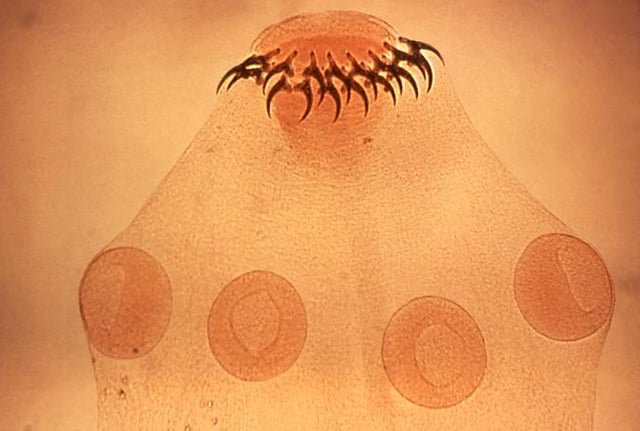 Head (scolex) of tapeworm Taenia solium, an intestinal parasite, has hooks and suckers to attach to its host.