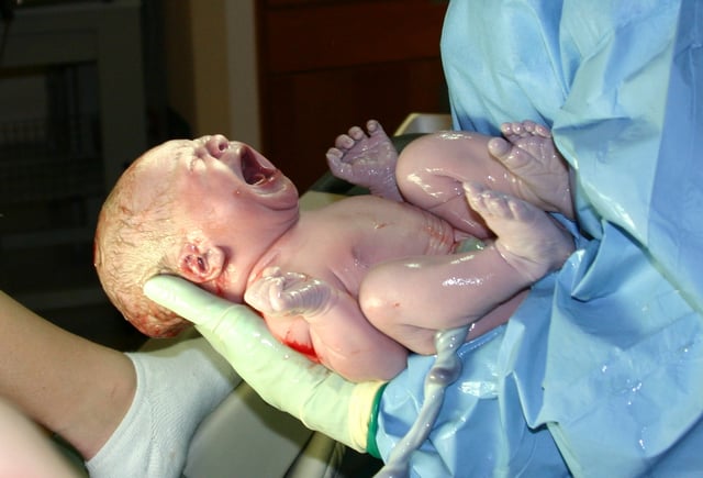 A newborn infant, seconds after delivery.
