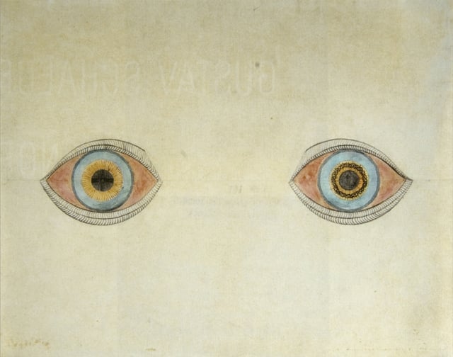 My Eyes at the Moment of the Apparitions by German artist August Natterer, who had schizophrenia