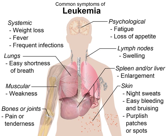 Common symptoms of chronic or acute leukemia