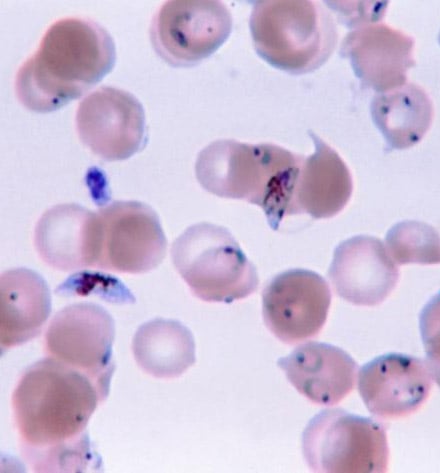 Ring-forms and gametocytes of Plasmodium falciparum in human blood