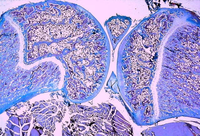 Section through a juvenile knee joint (rat) showing the cartilagineous growth plates