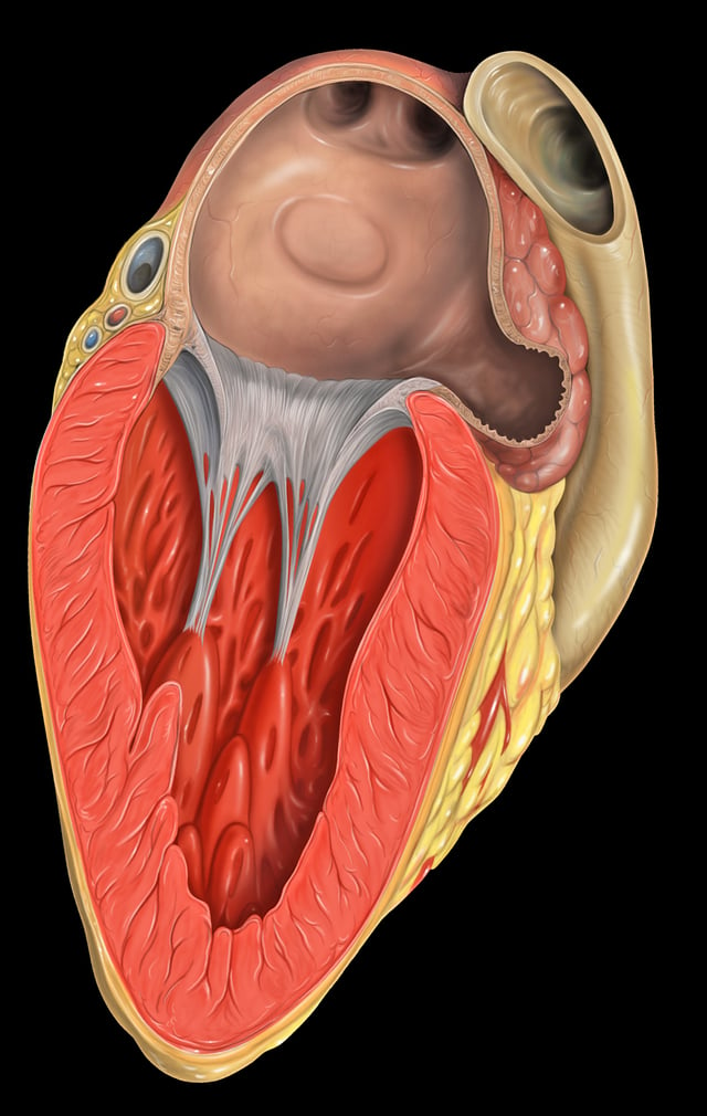 left atrial appendage shown at upper right