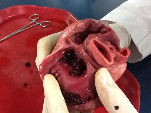 Heart being dissected showing right and left ventricles, from above