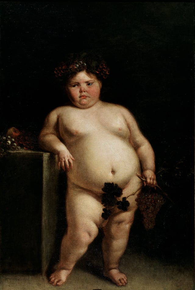 A 1680 painting by Juan Carreno de Miranda of a girl presumed to have Prader–Willi syndrome