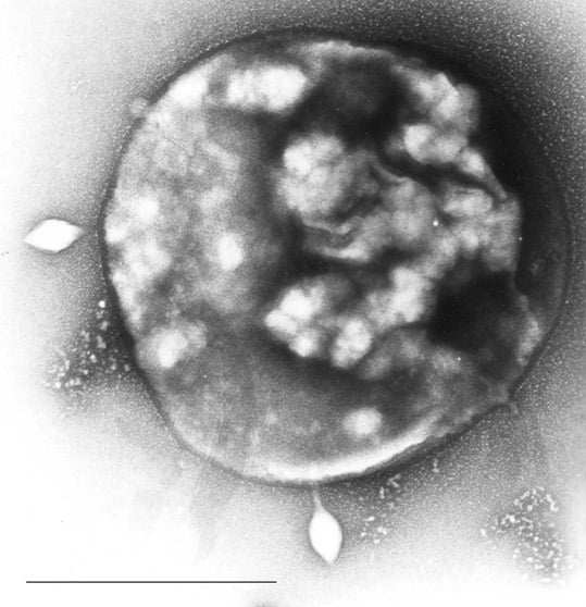 Sulfolobus infected with the DNA virus STSV1. Bar is 1 micrometer.