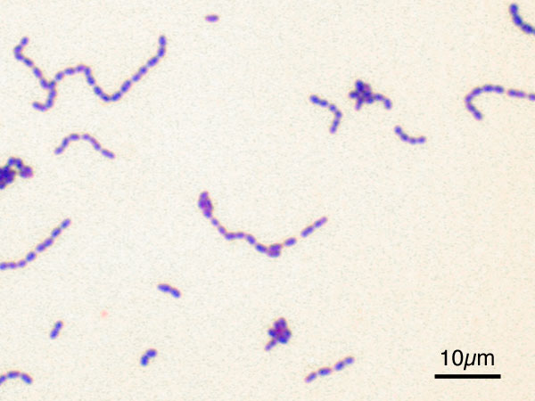 Streptococcus mutans visualised with a Gram stain
