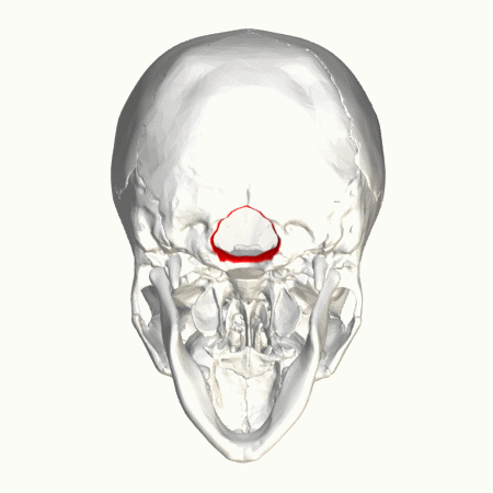 Cerebellar tonsils descend below the foramen magnum, the hole at the base of the skull.