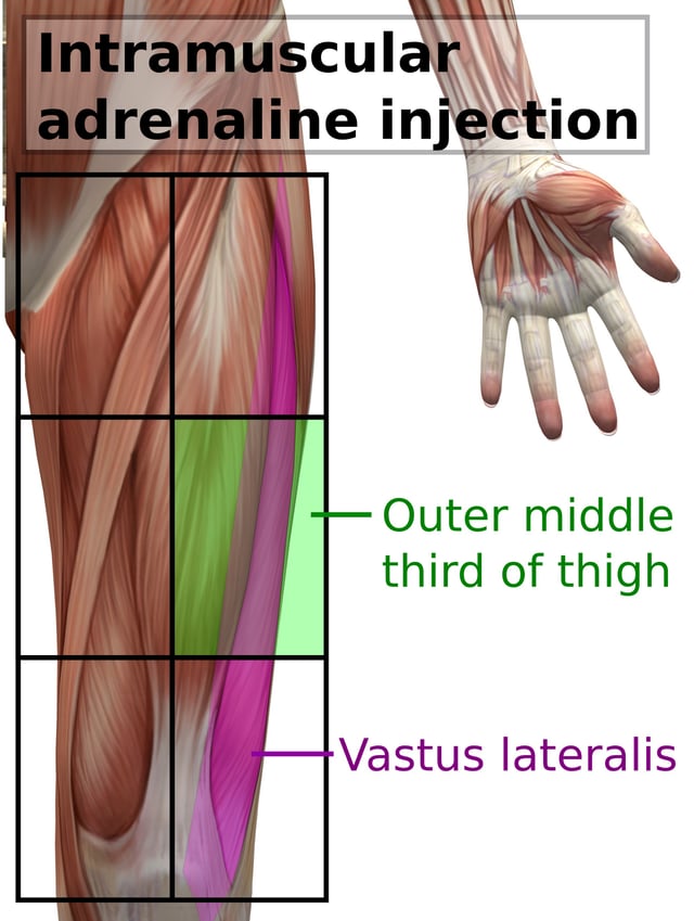 Vastus lateralis site for intramuscular injection