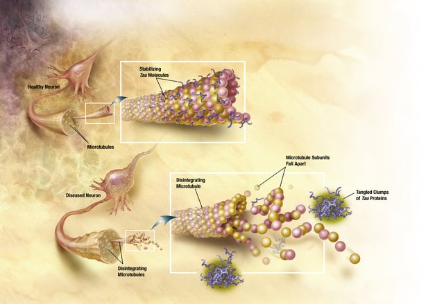 In Alzheimer's disease, changes in tau protein lead to the disintegration of microtubules in brain cells.