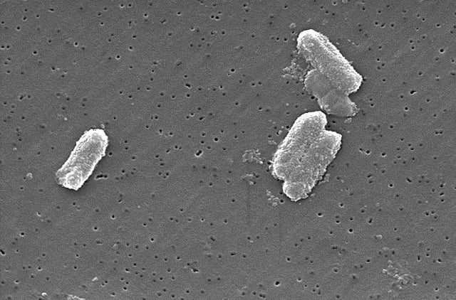 Citrobacter species can have concentrations of uranium in their cells 300 times the level of the surrounding environment.