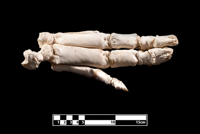 Skeleton of foot.