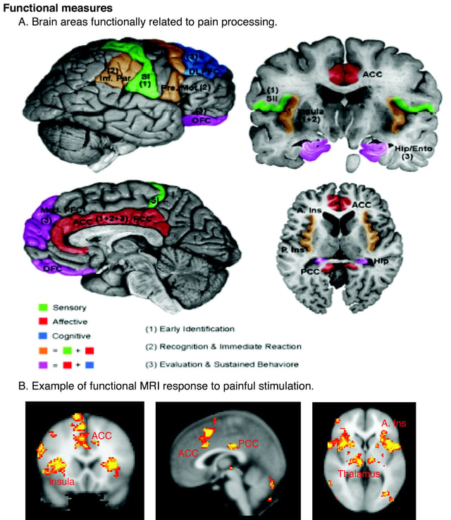 Regions of the cerebral cortex associated with pain.