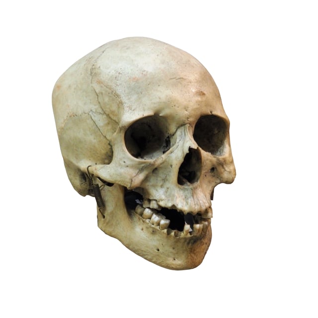 The skull of Homo sapiens, with its smaller teeth.