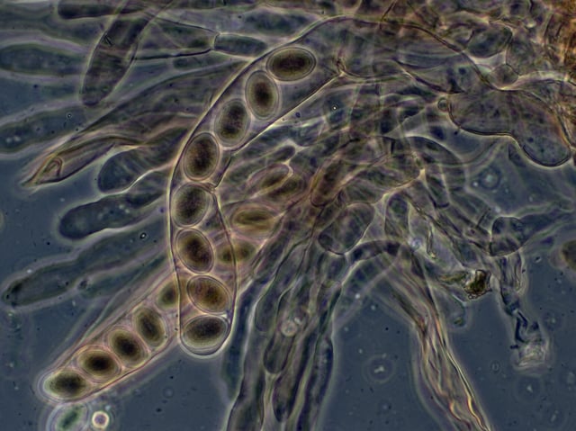 The 8-spore asci of Morchella elata, viewed with phase contrast microscopy