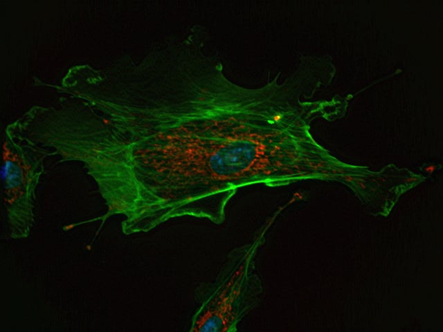 A fluorescent image of an endothelial cell.
