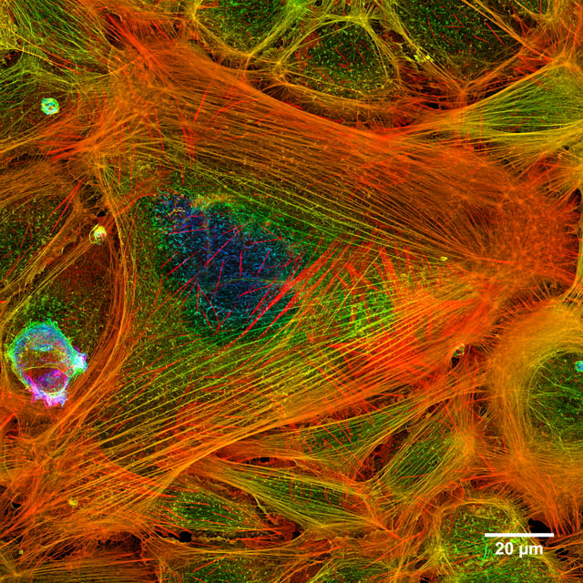 A merged stack of confocal images showing actin filaments within a cell.