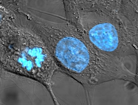 Human cancer cells, specifically HeLa cells, with DNA stained blue. The central and rightmost cell are in interphase, so their DNA is diffuse and the entire nuclei are labelled. The cell on the left is going through mitosis and its chromosomes have condensed.