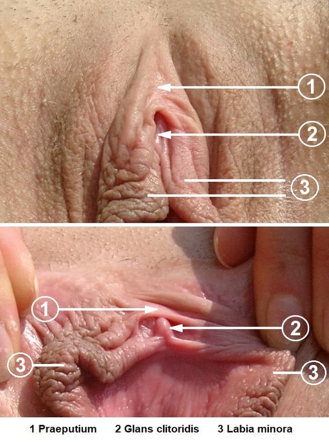 Clitoral hood (1) and clitoris (2). Labia are spread apart on the bottom image.