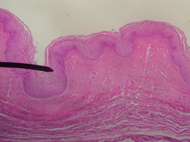 Medium-power magnification micrograph of a H&E stained slide showing a portion of a vaginal wall. Stratified squamous epithelium and underling connective tissue can be seen. The deeper muscular layers are not shown. The black line points to a fold in the mucosa.