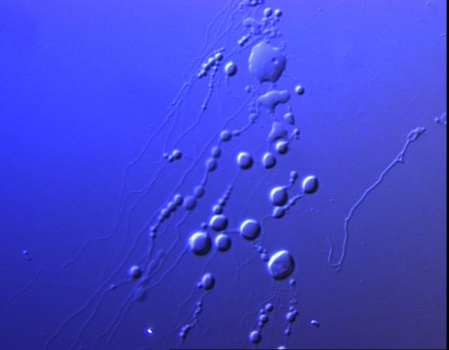 Sarfus image of lipid vesicles.