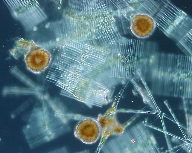 Phytoplankton, Lake Chūzenji