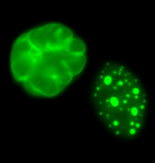 Untreated cells from children with the genetic disease progeria (left) compared to similar cells treated with FTIs